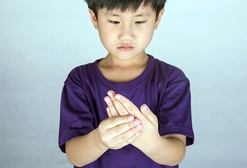 JRA symptoms and signs include swollen joints and joint pain and warmth.