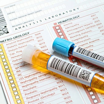 A nefro-urology report with urine and blood sample tubes.
