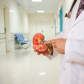 A doctor discussing kidney infection using an anatomical model of a human kidney.