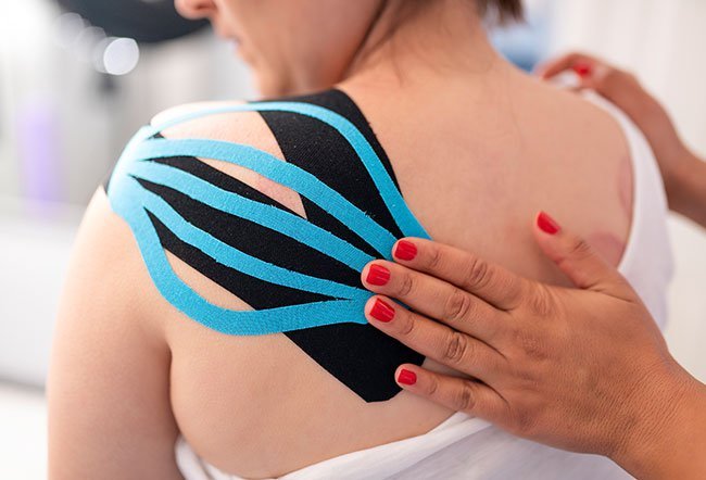 Kinesio Tex Tape (KT), or kinesiology tape, is used by therapists to change muscle tone, move lymphatic fluids, correct movement patterns, and improve posture.