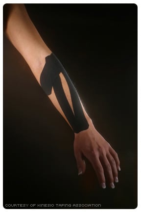 Picture of Kinesio Tape