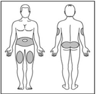 Choose your injection site - Illustration