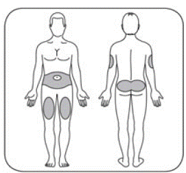 Choose your injection site. HUMULIN is injected under the
skin - Illustration