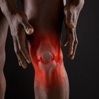 Bursitis is a painful medical condition of the knee bursa.