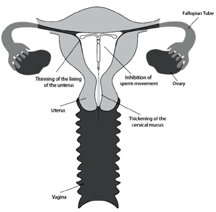 Flexible - Illustration