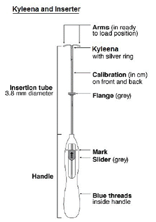 Opening the Kyleena Package - Illustration