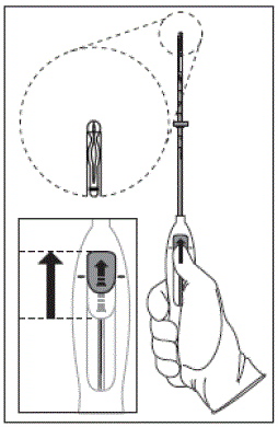 Setting the flange - Illustration