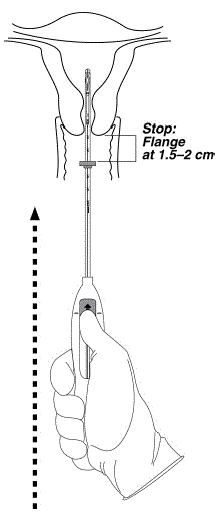 Move the slider back to the mark to release
and open the arms - Illustration