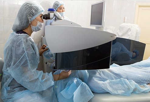 PRK Laser Surgery