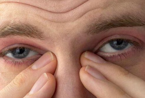 Your ophthalmologist will want to see you 1 or 2 days after surgery.