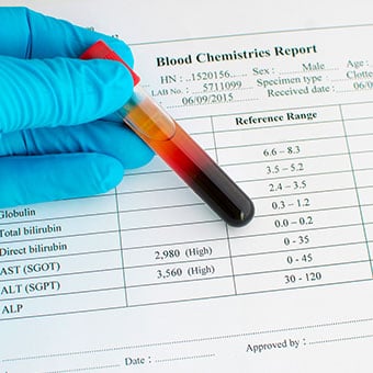 Blood test result 