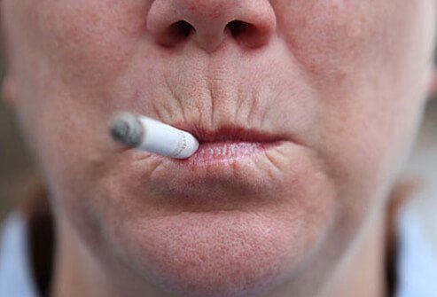 Smoking contributes to skin aging and heart disease risk.