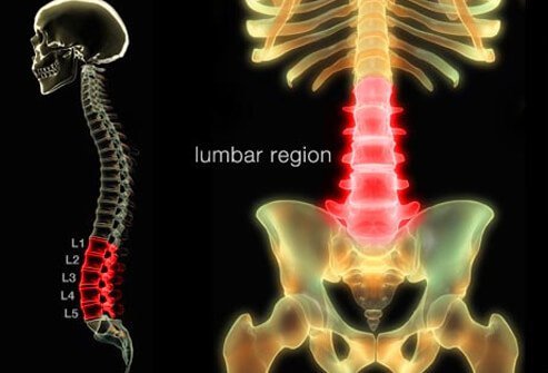Lower Back Pain