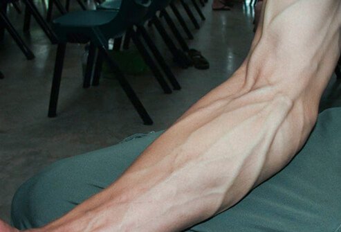 If blood pressure becomes too high, baroreceptors send signals to the veins instructing them to expand and store more blood and return less blood to the heart.