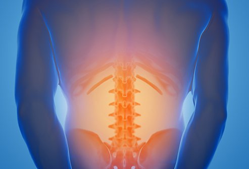 Discectomy vs Laminectomy