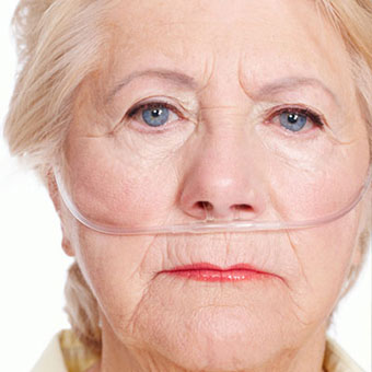 A senior woman with lung cancer wears breathing tubes for oxygen.