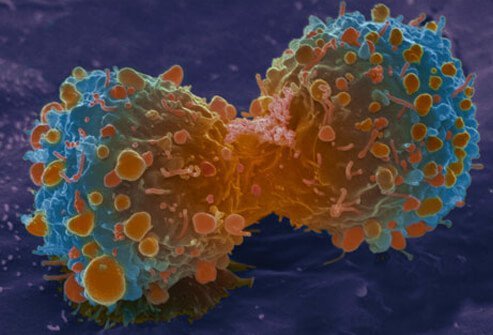 New therapeutic treatments are being tried.