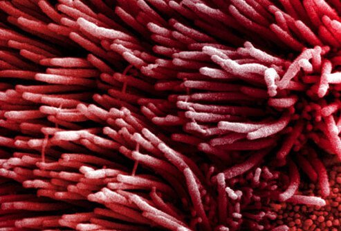 The exact cause of lung cancer is still being investigated.