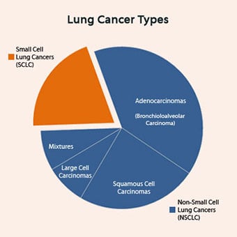 Pie chart of lung cancers types.