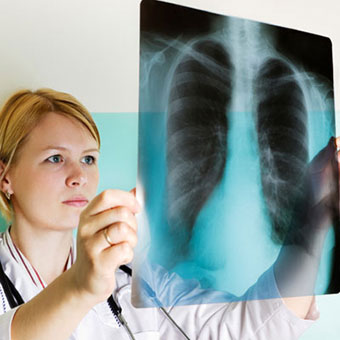 A doctor examines a lung X-ray.