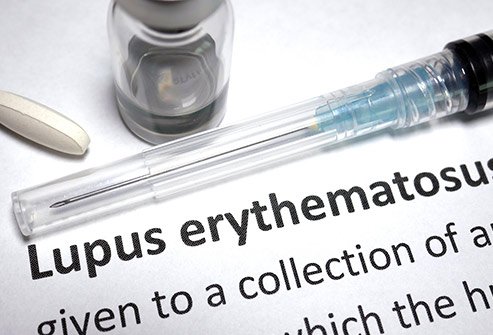 Lupus is a chronic autoimmune disease in which the body's immune system targets and attacks its own tissues and organs. 