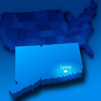 Lyme disease gets its name from the small coastal town of Lyme, Conn., due to a large outbreak there of children with the disease in 1975.