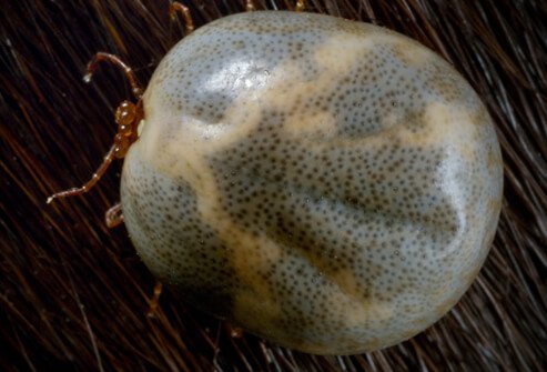 Lyme disease is caused by spiral-shaped bacteria called Borrelia burgdorferi (found in the U.S.) and Borrelia afzelii (found in Europe).