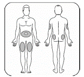 Choose your injection site - Illustration