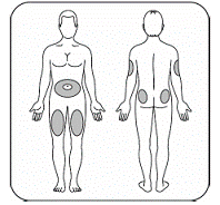 Choose your injection site - Illustration