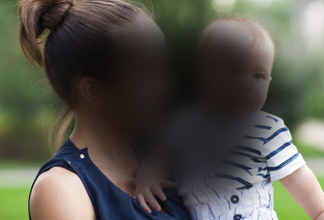 Macular degeneration causes blurred vision, trouble seeing fine details, and loss of central vision.
