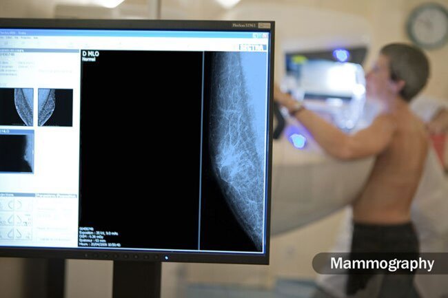 You will have follow-up visits after surgery to make sure everything's healing well.