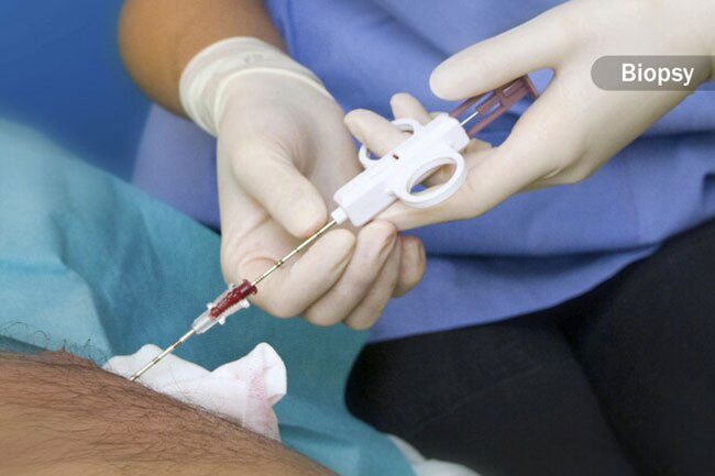 Depending on your symptoms, your doctor makes a diagnosis based on a combination of tests and procedures.