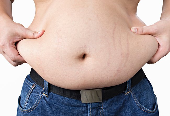 Being overweight is caused by many factors. It has been proven that not just one type of gene but many different genes are linked with being overweight and even with being obese.