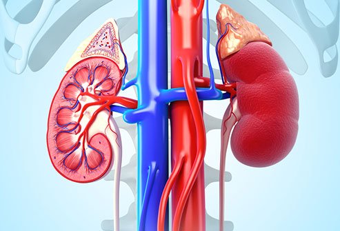 Kidney failure can require dialysis, an expensive treatment.