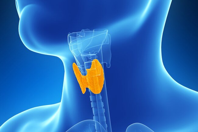 An underactive thyroid gland may cause you to pack on the pounds.