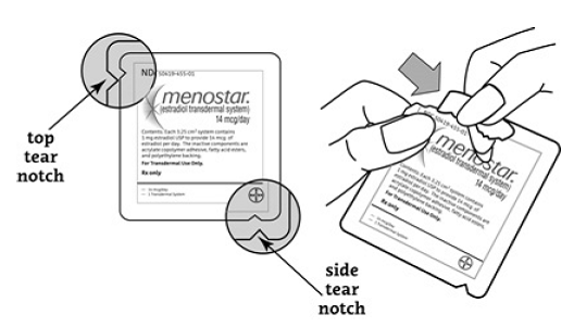 Remove the patch from its protective pouch by tearing at the notch - Illustration