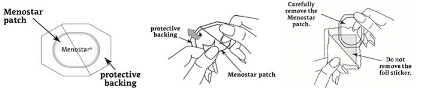 Remove the adhesive liner - Illustration