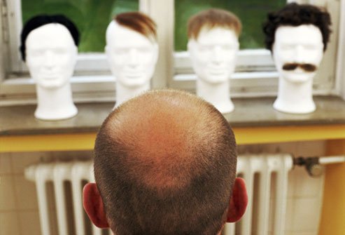 A hairpiece can help conceal hair loss.