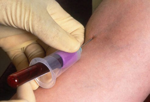 HIV-infected individuals can remain symptom-free for many years.