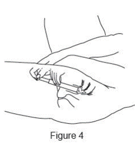 Inserting the applicator - Illustration