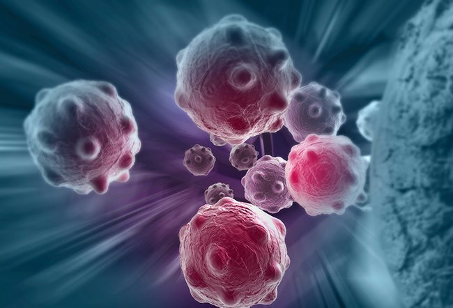 Cancer is a group of diseases that occur when abnormal cells spread uncontrollably throughout the body. The top three cancer killers are lung cancer, colorectal cancer, and breast cancer. 