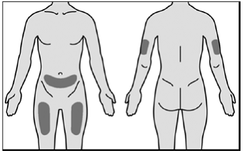 Injection site - Illustration