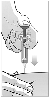 Pinch a fold of loose skin - Illustration