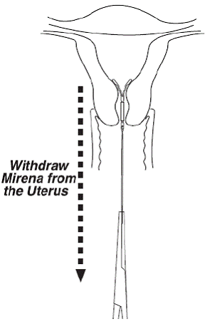 Proportion of Subjects with Successful
Treatment - Illustration