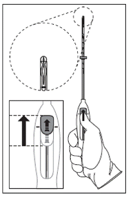 Advancing insertion tube until flange is 1.5
to 2 cm from the cervix - Illustration