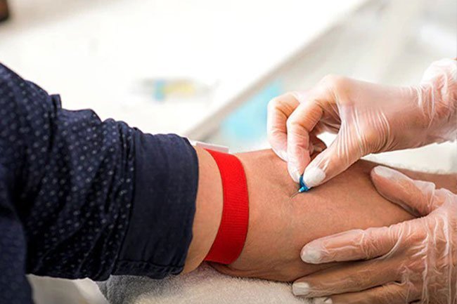Get your cholesterol levels measured frequently do you know what they are.
