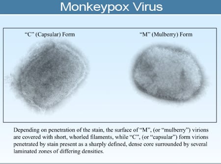 Monkeypox virus, brick-shaped negative stained virus grown in tissue cultures, visualized by electron microscopy