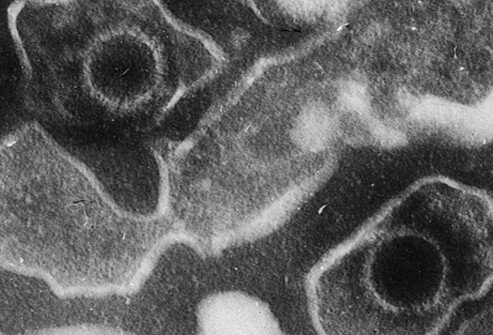 It's estimated up to 95% of adults in the U.S. have evidence of Epstein-Barr virus antibodies in their blood by the time they are 35 to 49 years old.