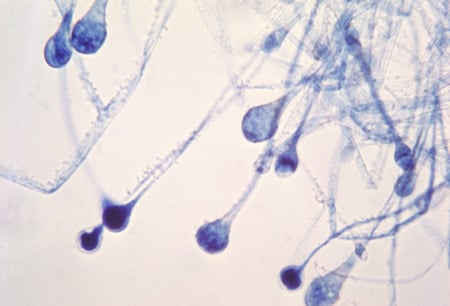 Picture of sporangia of a Mucor spp. fungus