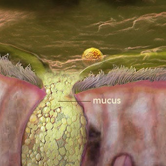 Green mucus, yellow mucus, and excessive phlegm can indicate infection.